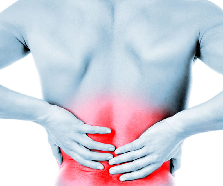 Mal di schiena o ernia